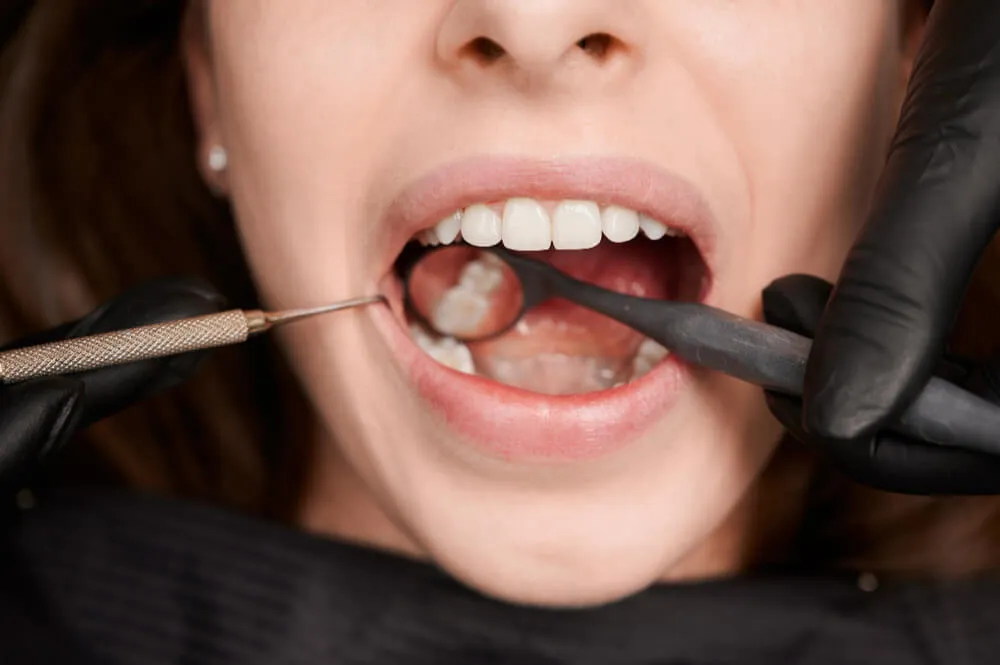 Beautiful female smile with white healthy teeth